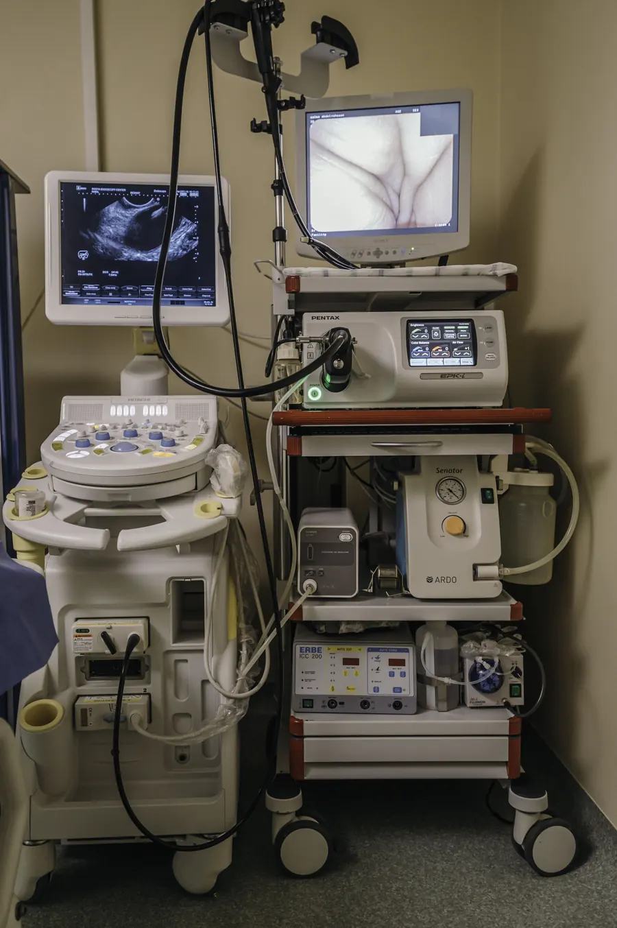 The endoscopy tower with its monitors