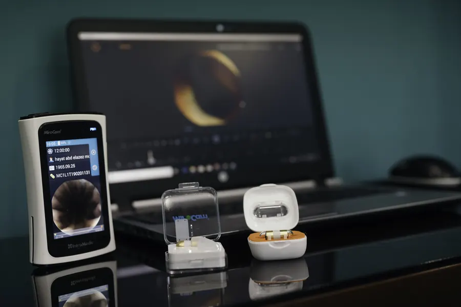 The capsule endoscopy kit: capsule, recorder and viewing software