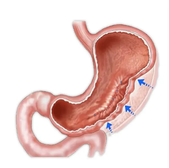 Illustration of the stomach